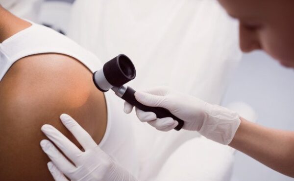 Na czym polega badanie dermatoskopowe znamion skórnych?
