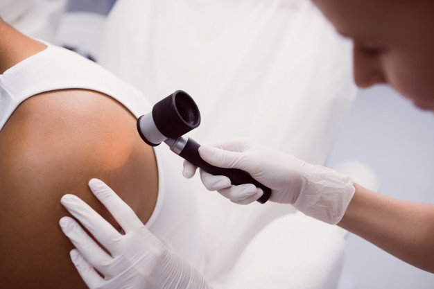 Na czym polega badanie dermatoskopowe znamion skórnych?