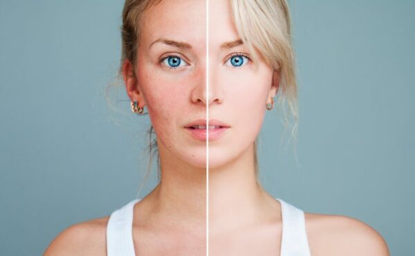Jak dbać o skórę twarzy po 30-stce?