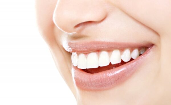 Przedłużanie zębów – coraz modniejszy zabieg stomatologiczny