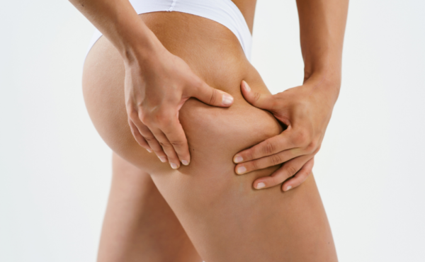 Top 5 zabiegów na cellulit!