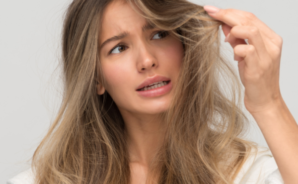 Zespół włosów niedających się uczesać – masz tę przypadłość?