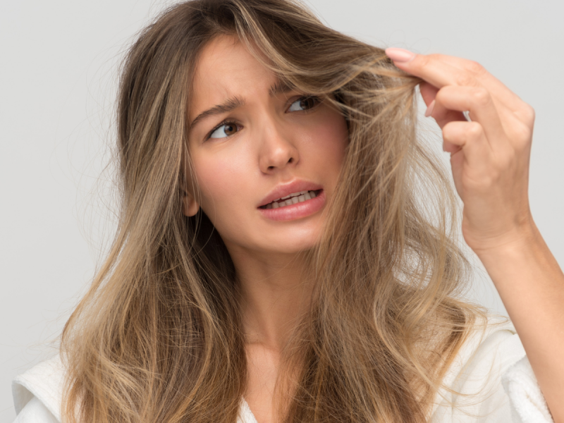 Zespół włosów niedających się uczesać – masz tę przypadłość?