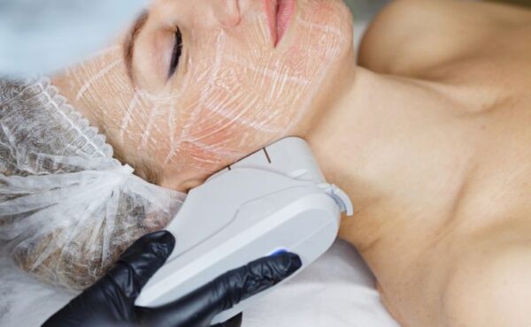 Poprawiasz urodę? Uważaj na HIFU!