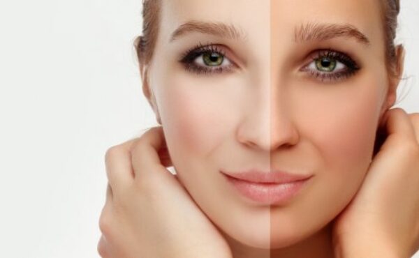 Samoopalacze – nasze opinie