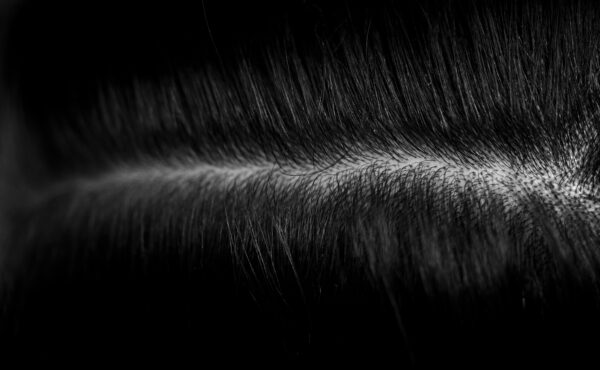 Mikropigmentacja skóry głowy – nowoczesne rozwiązanie dla osób z problemem łysienia