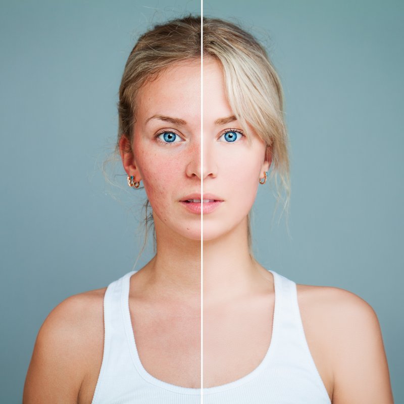 Jak dbać o skórę twarzy po 30-stce?